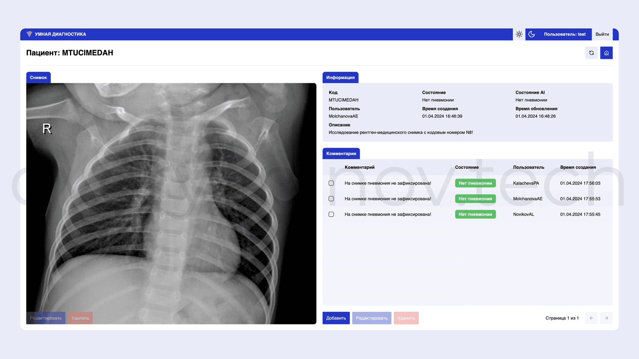 X-ray image data